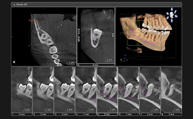 TOMOGRAFIA ODONTOLÓGICA COMPUTADORIZADA – Toigo Medicina e Odontologia